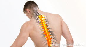 Pensacola thoracic spine pain image 