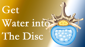 Pensacola Spinal Rehab Center uses spinal manipulation and exercise to boost the diffusion of water into the disc which supports the health of the disc.