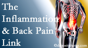 Pensacola Spinal Rehab Center tackles the inflammatory process that accompanies back pain as well as the pain itself.