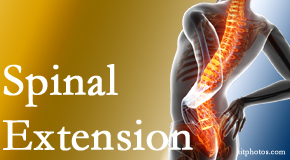 Pensacola Spinal Rehab Center knows the role of extension in spinal motion, its necessity, its benefits and potential harmful effects. 