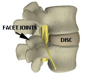 image of facet joints and disc in a spine