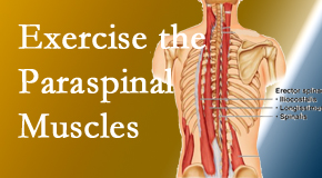 Pensacola Spinal Rehab Center explains the importance of paraspinal muscles and their strength for Pensacola back pain relief.