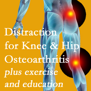 A chiropractic treatment plan for Pensacola knee pain and hip pain caused by osteoarthritis: education, exercise, distraction.