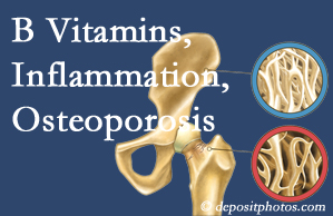 Pensacola chiropractic care of osteoporosis usually comes with nutritional tips like b vitamins for inflammation reduction and for prevention.