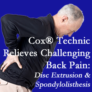 Pensacola chiropractic care with Cox Technic alleviates back pain due to a painful combination of a disc extrusion and a spondylolytic spondylolisthesis.
